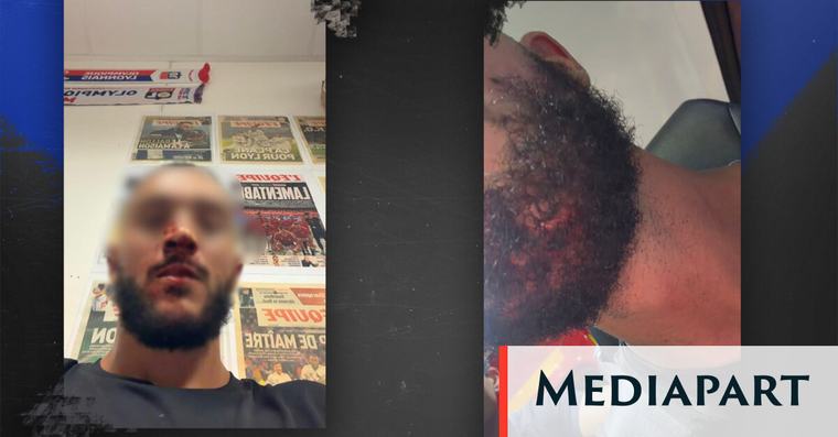 Des hooligans lyonnais pointés du doigt après deux agressions violentes