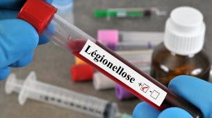 Santé. Légionellose : comment se protéger du risque de contamination ?